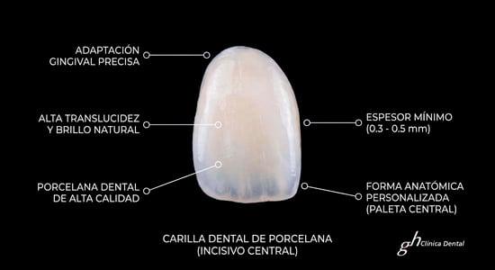 Carilla infografia ceramica
